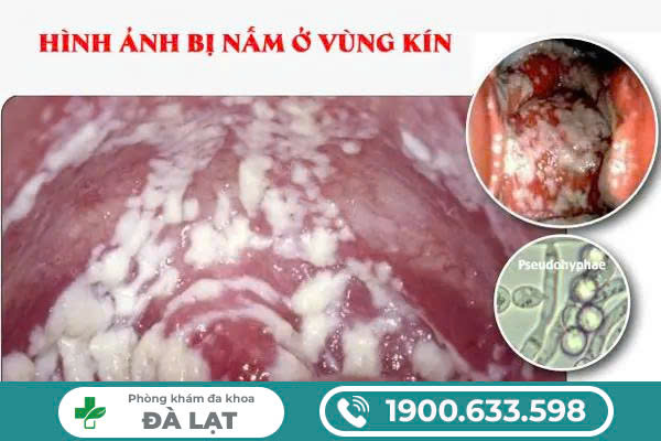 Hình ảnh minh họa